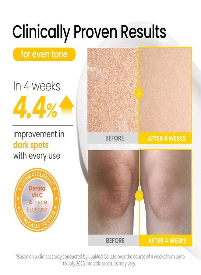#OOTD Vitamin C Body Lotion, 750ml (25.36 fl oz.) Gentle Daily Moisturizer with Niacinamide & Glutathione for Dry & Sensitive Skin - Image 3