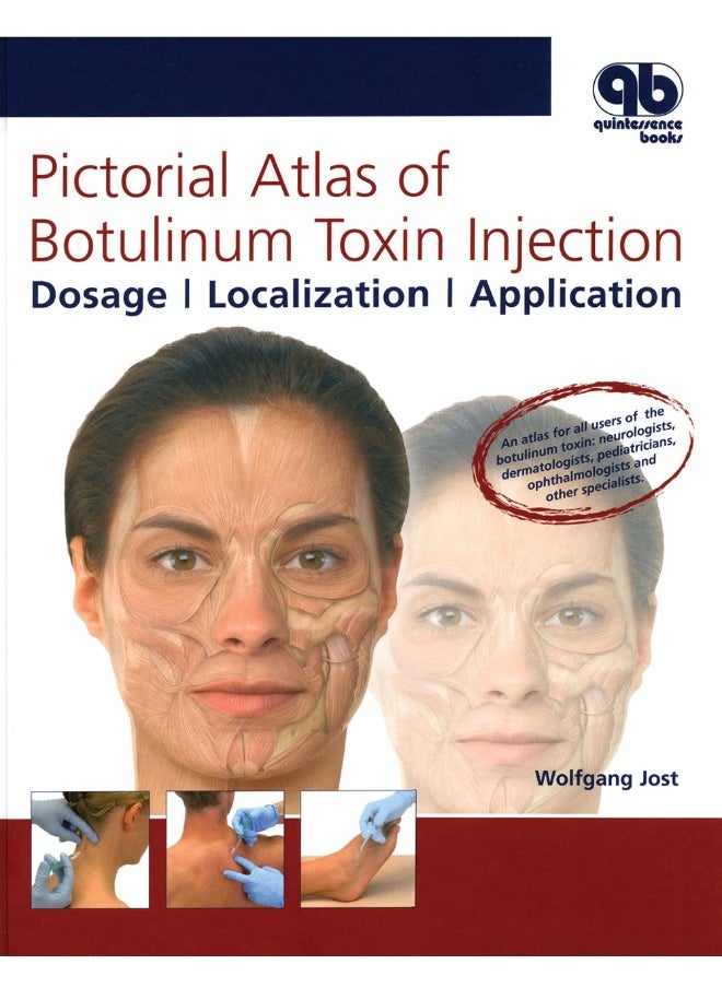 Pictorial Atlas of Botulinum Toxin Injection: Dosage, Localization, Application 
