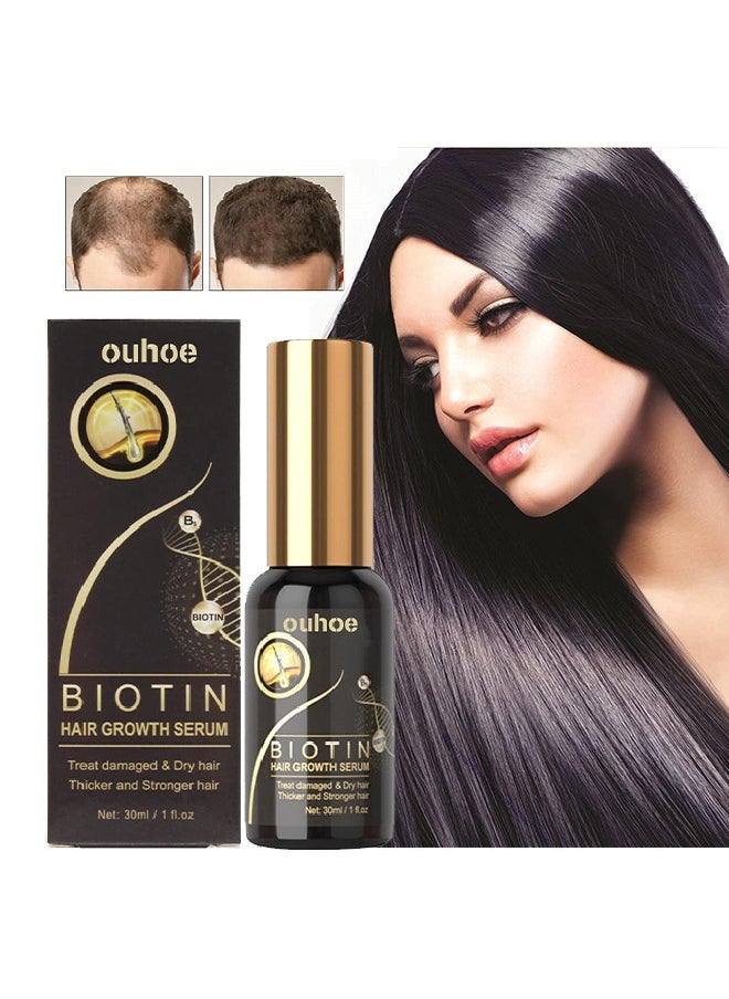 OUHOE - Biotin Hair Growth Serum 30ml,Can Promote Hair Growth,Hair Repair,Strong And Fragile Hair,Suitable For All Hair Types - Image 1