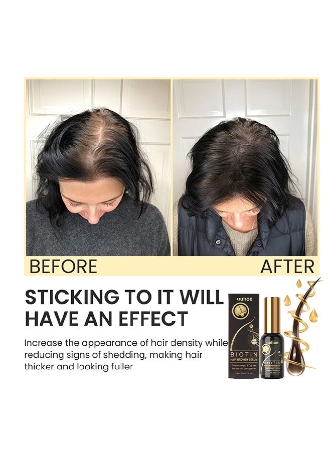 OUHOE - Biotin Hair Growth Serum 30ml,Can Promote Hair Growth,Hair Repair,Strong And Fragile Hair,Suitable For All Hair Types - Image 1