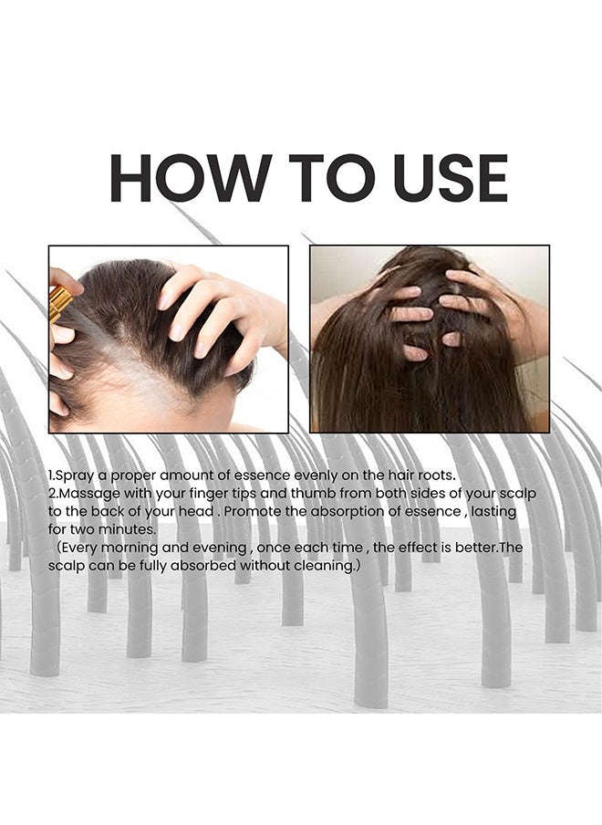 OUHOE - Biotin Hair Growth Serum 30ml,Can Promote Hair Growth,Hair Repair,Strong And Fragile Hair,Suitable For All Hair Types - Image 1