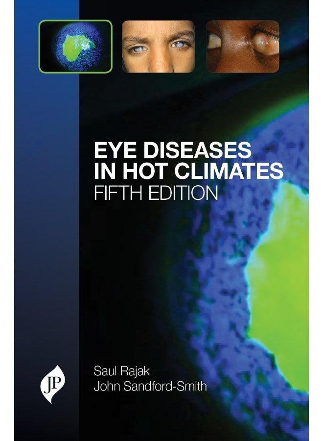 Eye Diseases in Hot Climates