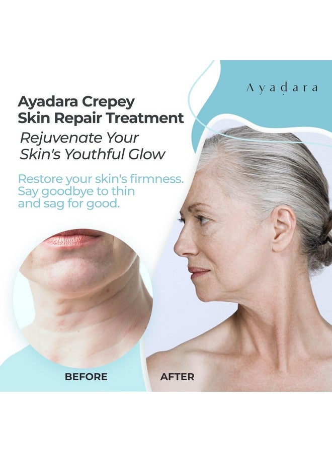AYADARA Yadara Crepey Skin Repair Treatment 8Oz Firming Lotion For Loose Skin Crepe Corrector Collagen Cream For Body Skintightening Wrinkle Cream For Face Neck Arms And Legs 500+ Uses - Image 3