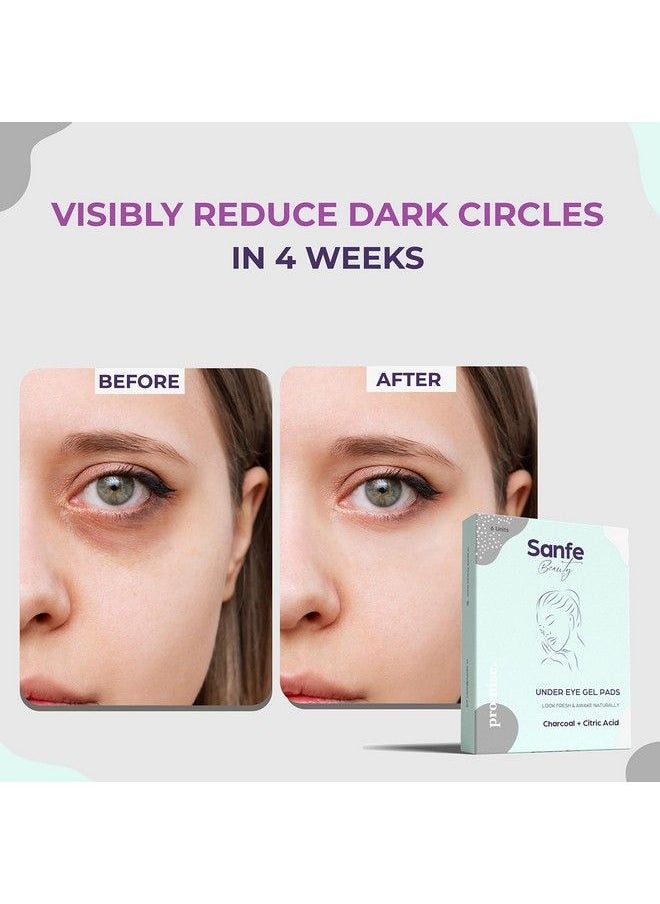 Sanfe Under Eye Gel Pads For Dull Tiredlooking Eyes ; Enriched With Charcoal & Citric Acid ; Under Eye Patch That Hydrates Rejuvenates & Lightens ; Nourishing Gel Pack Of 6  - Image 3