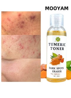 MOOYAM Turmeric Dark Spot Correcting Toner, Facial Toner for Acne Prone Skin,Blemish Removing Facial Moisturizer  Hyperpigmentation Treatment，Anti-aging Moisturizing Essential Care Brighten Improve Fine Line  - Image 1