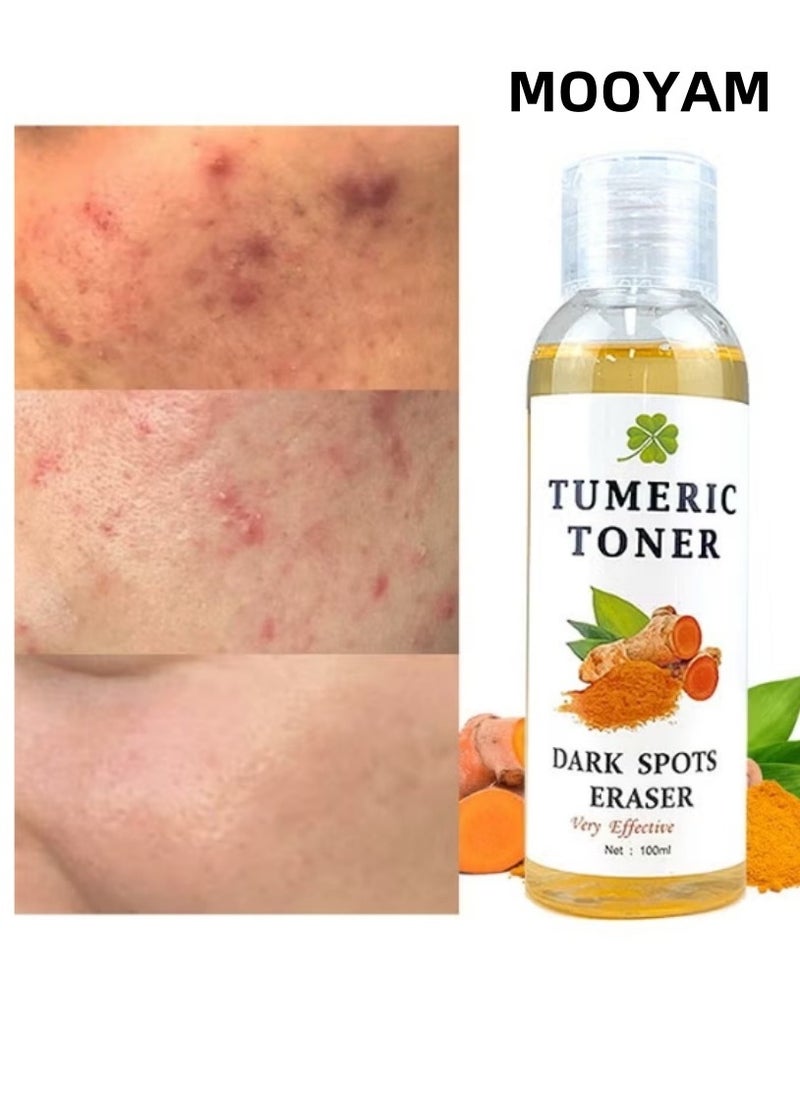 MOOYAM Turmeric Dark Spot Correcting Toner, Facial Toner for Acne Prone Skin,Blemish Removing Facial Moisturizer  Hyperpigmentation Treatment，Anti-aging Moisturizing Essential Care Brighten Improve Fine Line  - Image 1