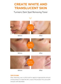 MOOYAM Turmeric Dark Spot Correcting Toner, Facial Toner for Acne Prone Skin,Blemish Removing Facial Moisturizer  Hyperpigmentation Treatment，Anti-aging Moisturizing Essential Care Brighten Improve Fine Line  - Image 5