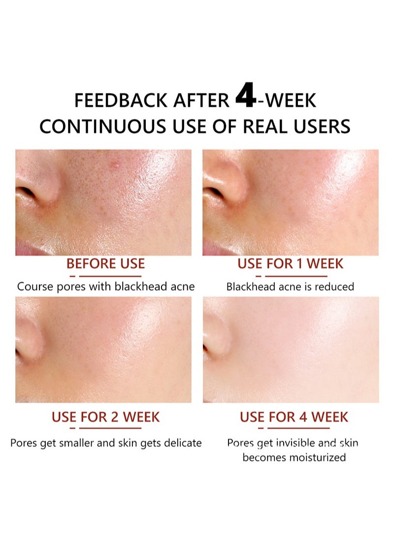Vibrant Glamour - 2Pcs FDA Salicylic acid Serum 30ml Shrink Pores Hyaluronic Acid Pore Minimizer Serum Relieve Dryness Whitening Refining Firming Moisturizing Oil Control Repairing Smooth Skin Care - Image 1