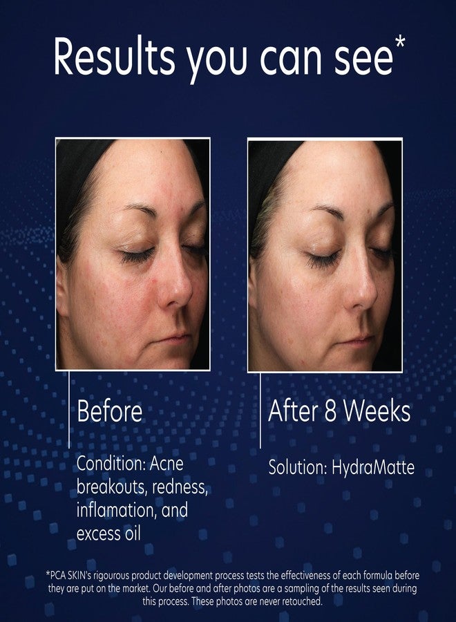 PCA SKIN مرطب PCA SKIN هايدرا مات للتحكم في الزيوت، مرطب للوجه للبشرة الدهنية، يساعد في تقليل الزيوت ويعزز بشرة أكثر نعومة، يمتص بسرعة، رائع للبشرة المختلطة والدهنية، 1.8 أونصة في جرة - Image 4