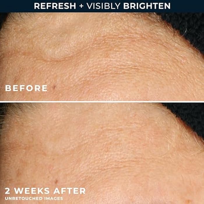 RoC Multi Correxion Revive + Glow Gel Vitamin C Cleanser, Face Wash, Facial Cleanser with Glycolic Acid, Paraben-Free, Sulfate-Free Skin Care - 6 Ounces - Image 5