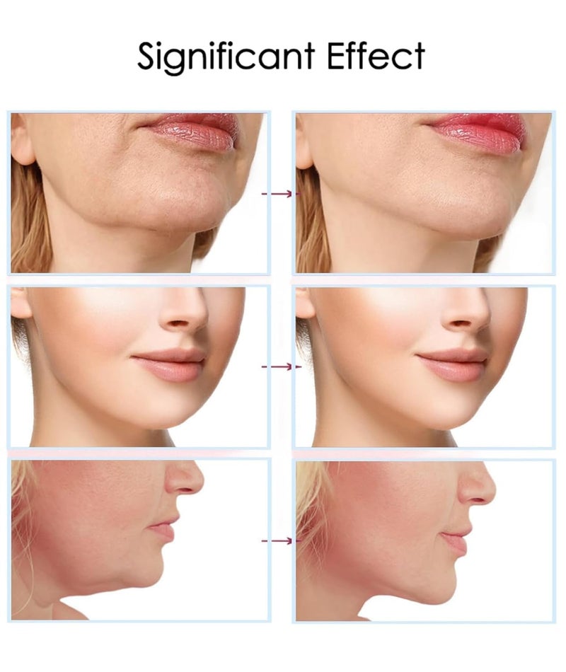 RIPIENO RIPIENO V shaped Mask Invisible Tape Soft Elastic Face Adhesive Tape Lifting Firming Instant Wrinkle Stickers Elasticity Makeup Tape for Eyes Neck Jaw ChinTransparent Instant Face Lift - Image 5