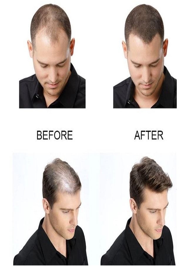 Caffeine C1 Anti Hair Loss Essential Oil For Men & Women 30 ml