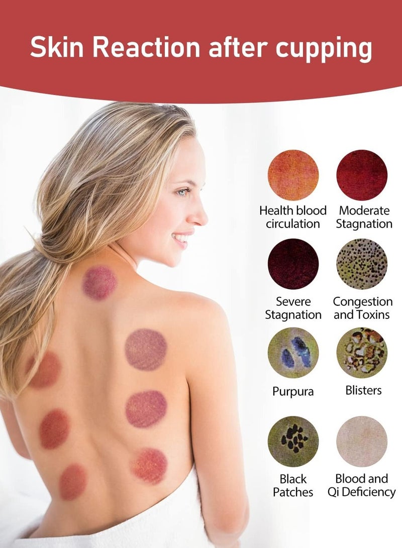 general Cupping Therapy Set, 4 in 1 Cupping Set with 12 Massage Modes, Electric Cupping Device for Cellulite Removal, USB Rechargeable Cupping Set - Image 4