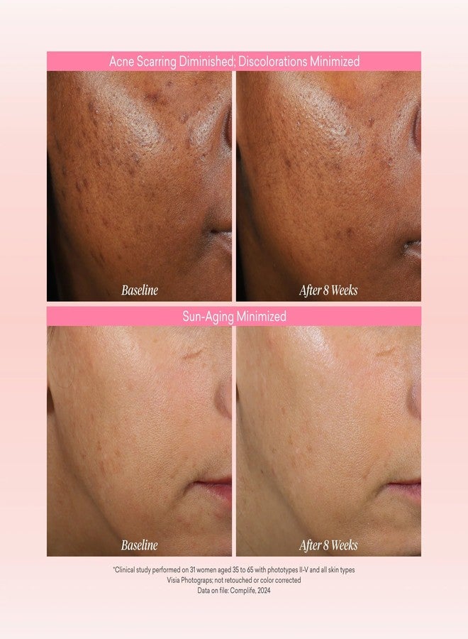 toty. toty By Sofia Vergara - Reversa Retinol Photoage-Defying Serum - Anti-Aging to Reduce Lines and Wrinkles for Firm and Plump Skin - 0.5% Micro-Encapsulated Retinol, 5% Niacinamide, 2% NAG - 1.0 fl oz - Image 3