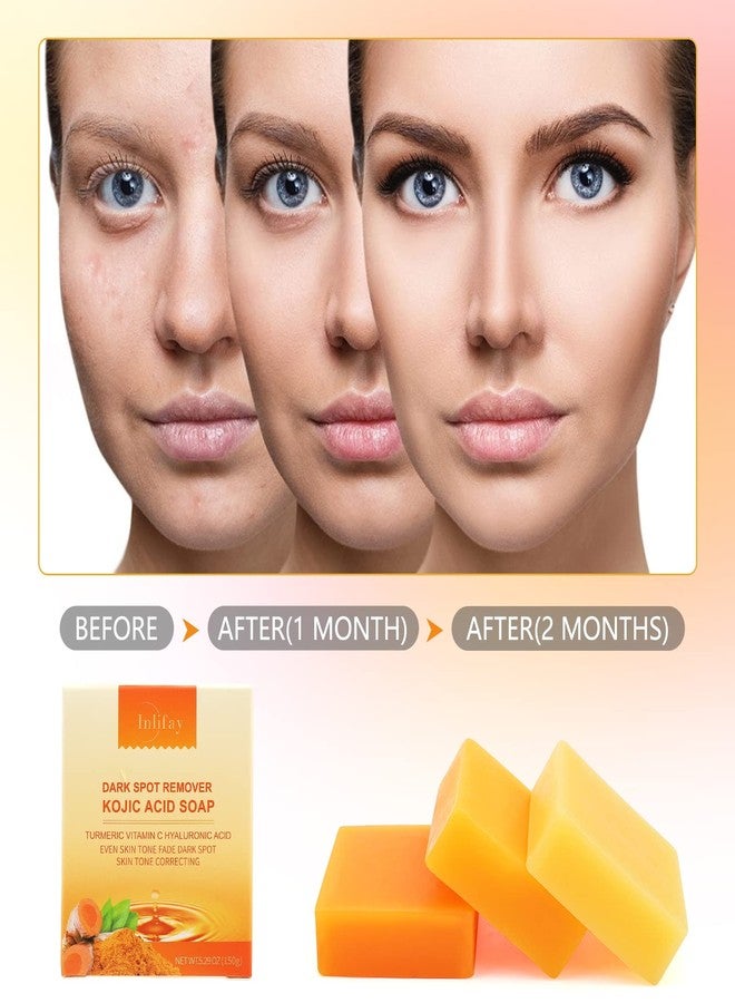 Inlifay Kojic Acid Soap with Turmeric: Dark Spot Remover Soap with Vitamin C, Vitamin E, Retinol, Collagen, Hyaluronic Acid, Moisturizing for Body & Face Pack of 2 - Image 2