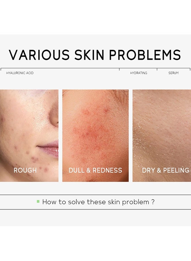 كويوم سيروم ترطيب بحمض الهيالورونيك 30 مل - ترطيب متعدد الطبقات للبشرة الجافة، يقلل التجاعيد ويقوي الحاجز الجلدي - Image 2