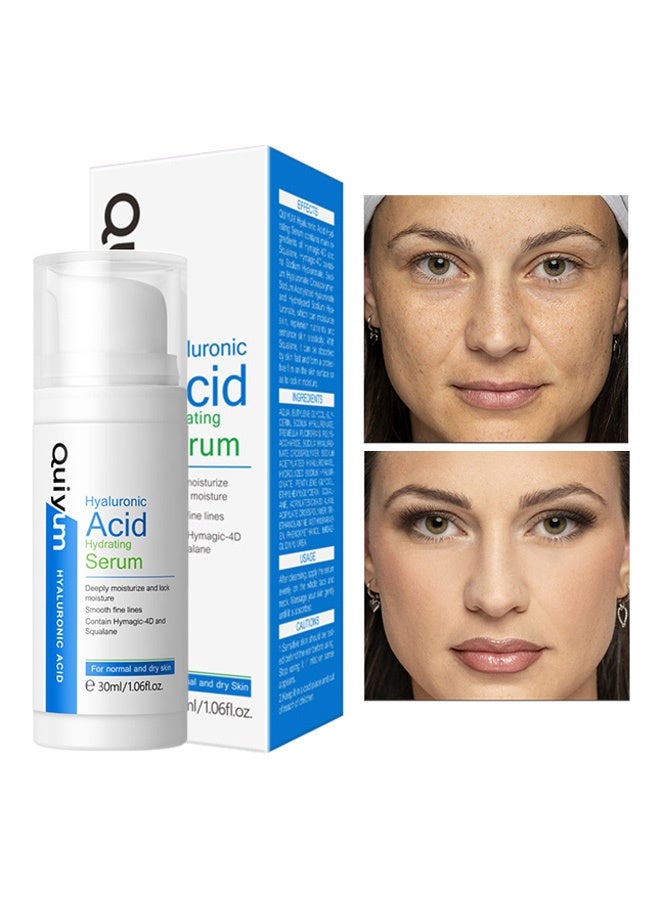 كويوم سيروم ترطيب بحمض الهيالورونيك 30 مل - ترطيب متعدد الطبقات للبشرة الجافة، يقلل التجاعيد ويقوي الحاجز الجلدي - Image 1