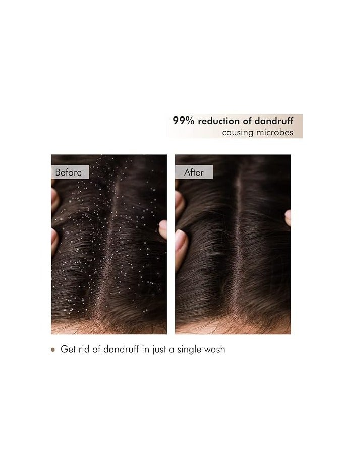 mCaffeine Anti Dandruff Coffee Scalp Scrub - 99% Dandruff Control Treatment for Men & Women | Scalp Exfoliator & Dandruff Remover | For Itchy Scalp in Hot & Humid Weather- 250gm  - Image 3