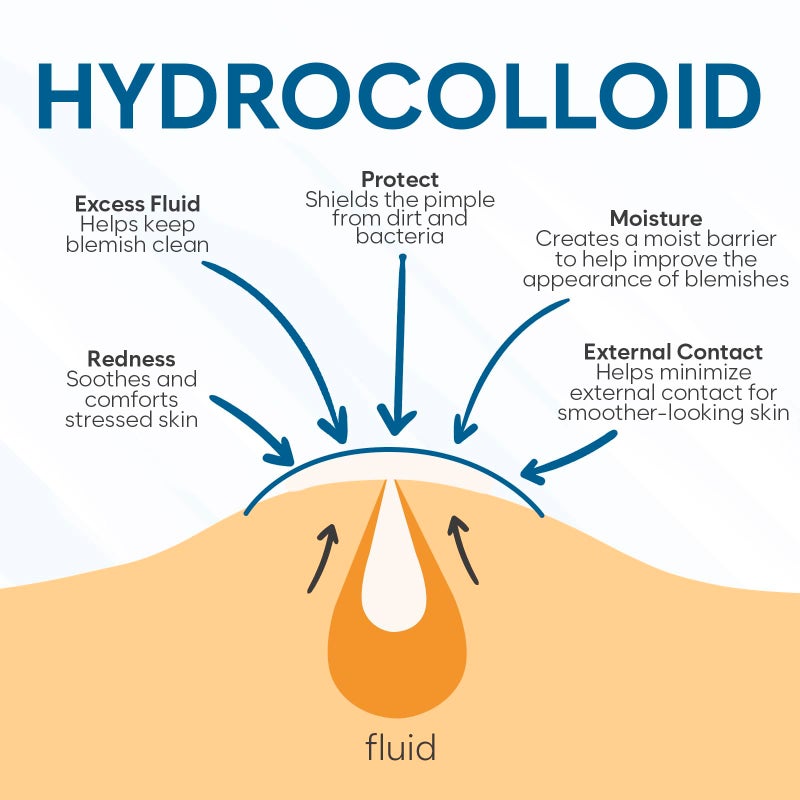 BLOOMORA Invisible Pimple Patches for Face (324 Count), Zit Patches for Blemishes, Hydrocolloid Bandages, Zit Stickers for Face - S/L Sizes - Image 2