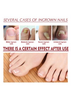 Jaysuing Anti Paronychia Relief Oil Effective Best Nail Repair Solution Ingrown Toenail Treatment Pain Relief Oil for Damaged Thick and Discoloration Nail for Toenail Care  - Image 3