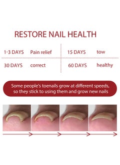 Jaysuing Anti Paronychia Relief Oil Effective Best Nail Repair Solution Ingrown Toenail Treatment Pain Relief Oil for Damaged Thick and Discoloration Nail for Toenail Care  - Image 4