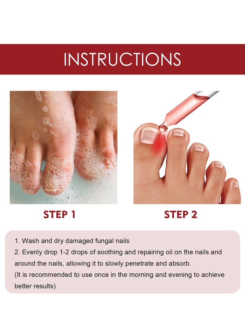 Jaysuing - Anti Paronychia Relief Oil Effective Best Nail Repair Solution Ingrown Toenail Treatment Pain Relief Oil for Damaged Thick and Discoloration Nail for Toenail Care - Image 1