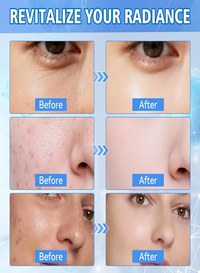 AstraVox Glycolic Acid 20% Exfoliating Pads 60 Pcs, Resurfacing Face Peel & Toner Pads with 2% Salicylic Acid, Vitamin C&E for Face & Body, Skin Care for Clogged Pores, Dark Spots & Fine Lines - Image 4