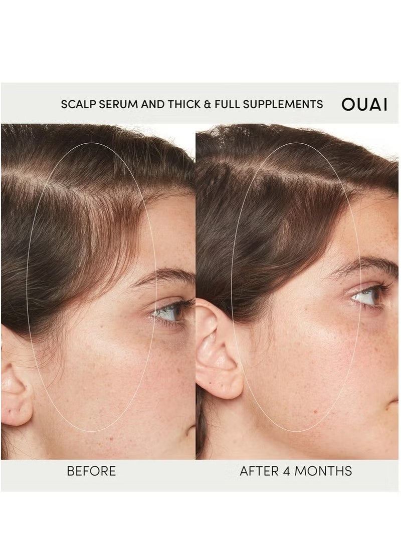 OUAI Scalp Serum – Hydrating & Balancing Formula for Thicker, Fuller, Healthier-Looking Hair (2 fl oz) - Image 2