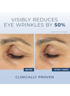 RoC RoC Retinol Correxion Anti-Aging Eye Cream Treatment for Wrinkles, Crows Feet, Dark Circles, and Puffiness.5 fl. oz  - Image 4