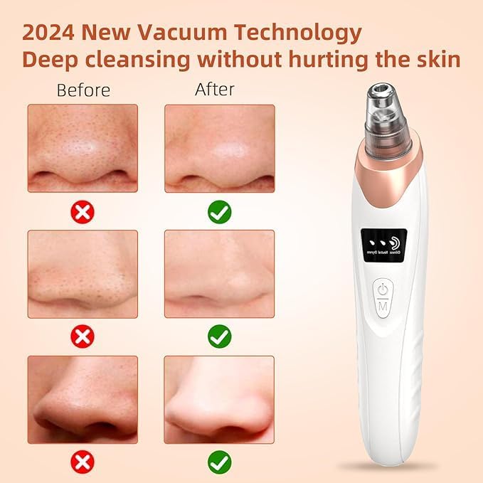 ADAK 2025 Electric Blackhead Remover Vacuum – 5 Adjustable Suction Levels + Probes, USB Rechargeable Facial Pore Cleaner, Acne Extractor & Skin Care Device for Adults (Extra 4 Pcs Tools) - Image 2
