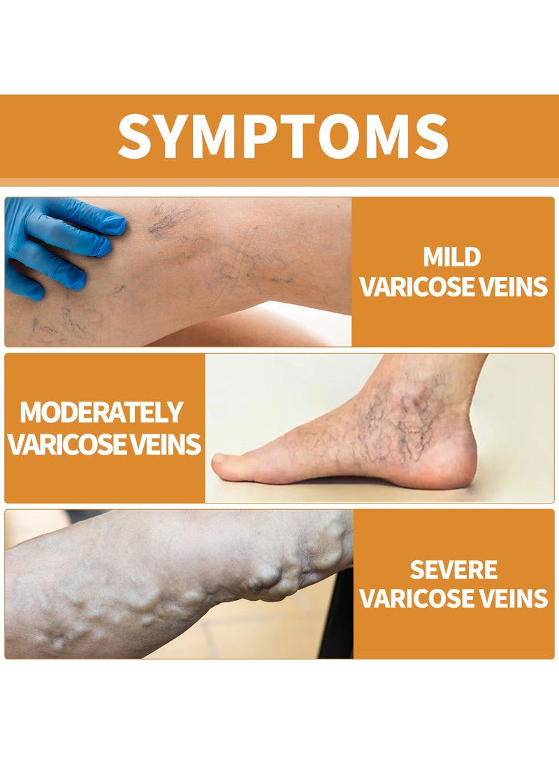 ساوث مون عبوة من 3 بخاخات مهدئة للدوالي، تقلل من الدوالي وتخفف التورم والألم 30 مل*3 - Image 3