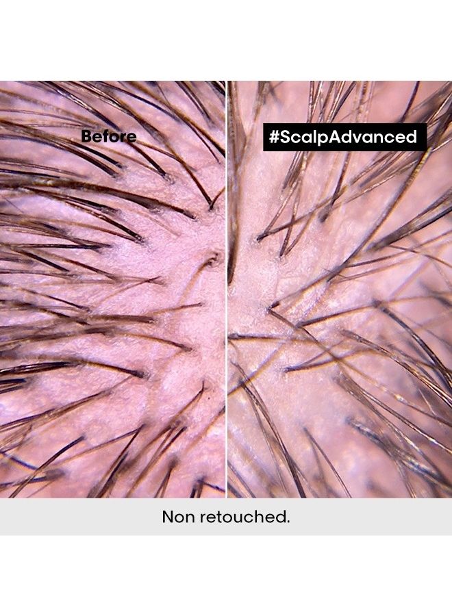 L'Oréal Professionnel Scalp Advanced Anti-Discomfort Intense Soother Treatment - Image 5