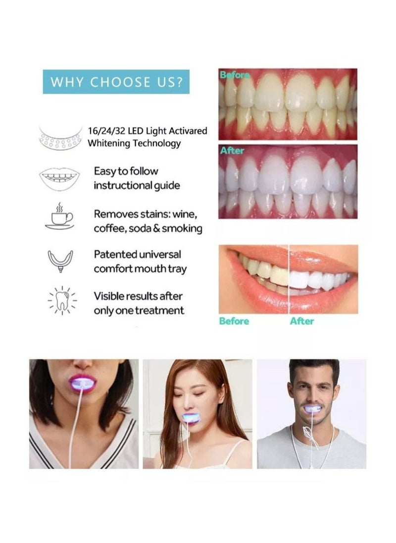 SMILEKIT - Ultra LED Teeth Whitening Kit - Image 1