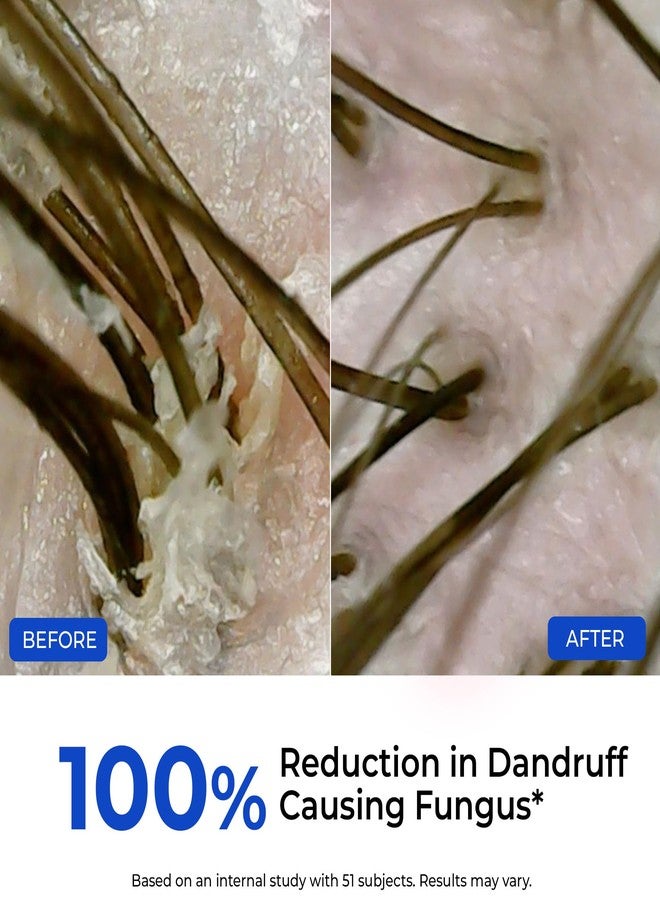 Conscious Chemist Anti-Dandruff Scalp Exfoliator 50ml | Pre-Wash Scalp Treatment for Flakes & Itchy Scalp | Relieves Visible Dandruff | Powered by FlakeShield™ Technology | Suitable for Men & Women - Image 4