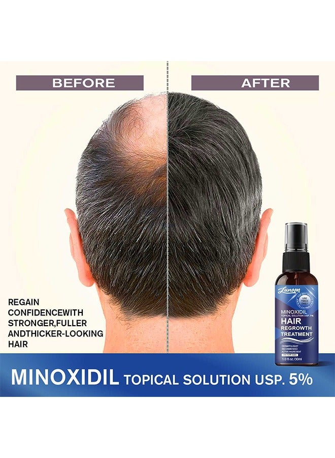 LUNOON Minoxidil Hair Regrowth Treatment - Growth Spray For Men And Women, 5% Minoxidil Hair Serum For Stronger Thicker Longer Hair Help To Stop Thinning And Loss Hair 30ML - Image 5