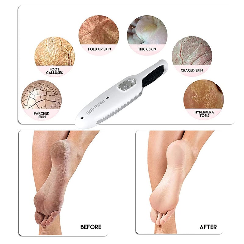 Painless Electric Callus Remover Rechargeable Cordless Foot File Easy Grip Adjustable Power Pedi Feet Care for Dead Hard Skin Cracked Heels CR01 Pink 5 Piece Set white - Image 4