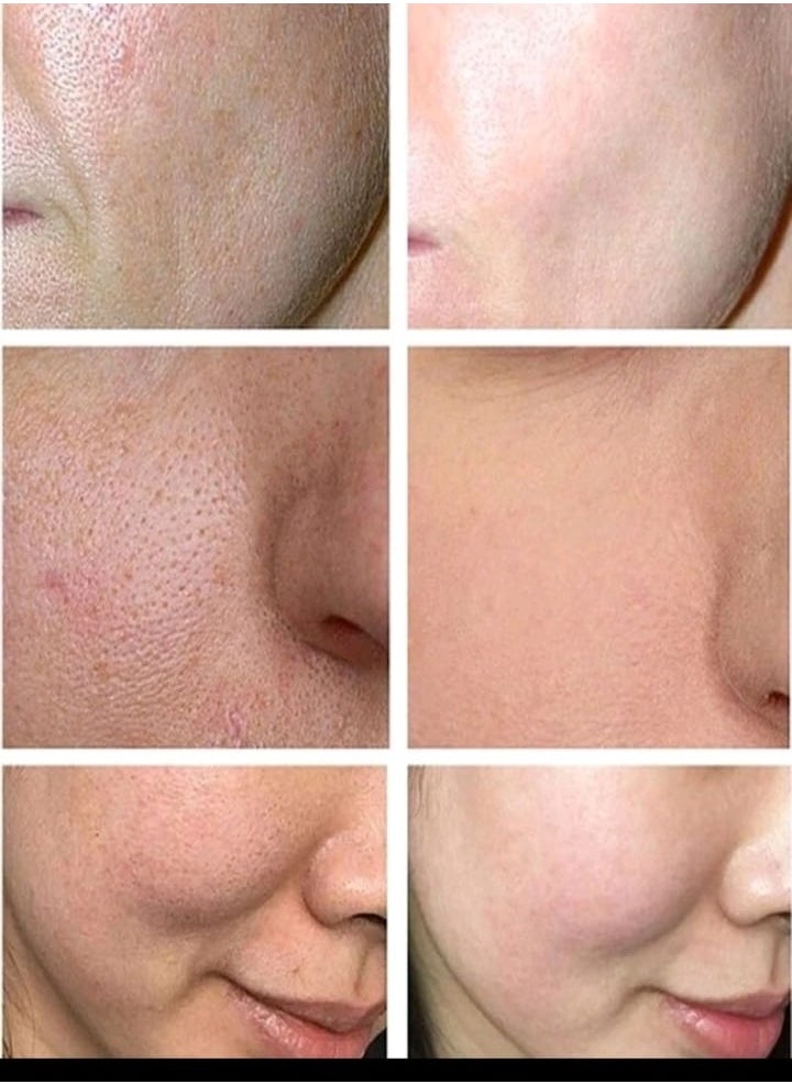 TRSTAY - Face Serum Deep Repairing Moisturizing Anti Aging Pretty Home - Image 1
