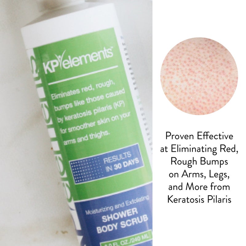 KP Elements Body Scrub (8 fl oz) | Keratosis Pilaris Treatment | Exfoliating Body Scrub and Body Moisturizer for Dry Skin | Helps Reduce Red Bumps | Body Skin Care Product for Men and Women - Image 2
