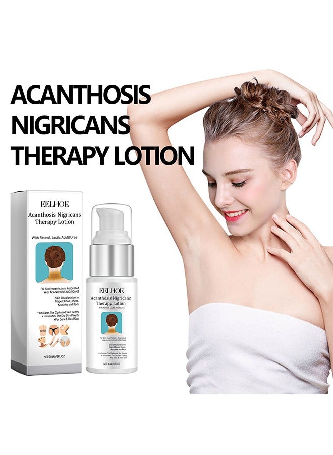 EELHOE Black acanthosis repair emulsion, Skin Moisturizing Cream 30ml, Anti-Aging, Moisturizing, Anti-Wrinkle, Whitening and Firming - Image 1