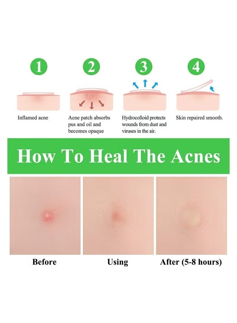 Breylee 66 Patchs Acne Pimple Patch Transparent - Image 5