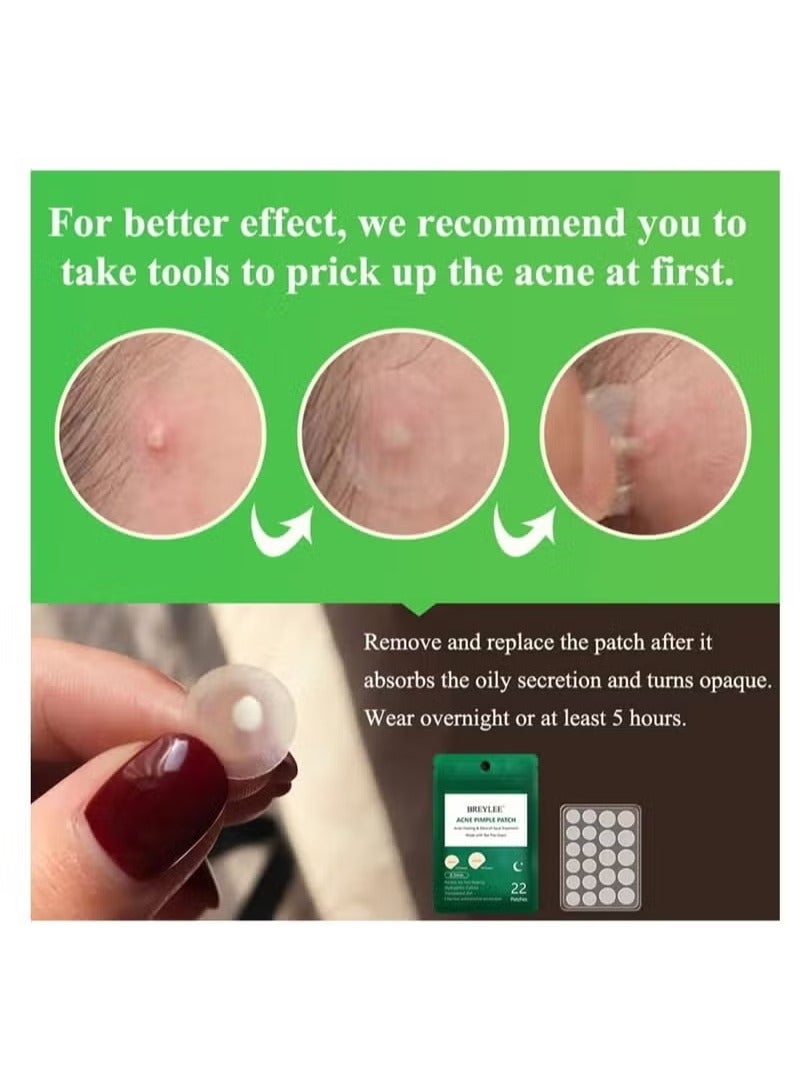 Breylee 66 Patchs Acne Pimple Patch Transparent - Image 4