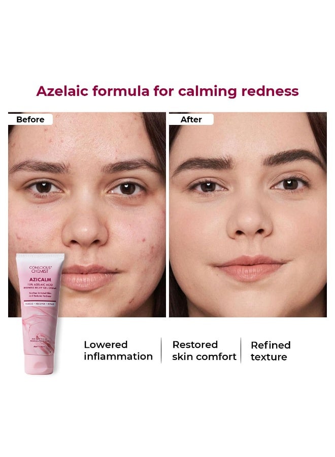 كيميائي واعي كريم حمض الأزيليك 10% من كونشيس كيميست® | 50 غرام | كريم للوجه للرجال والنساء، مرطب للبشرة المعرضة لحب الشباب، يخفف الاحمرار، يهدئ التهيج والالتهاب، مناسب لجميع أنواع البشرة - أزيكالم - Image 2