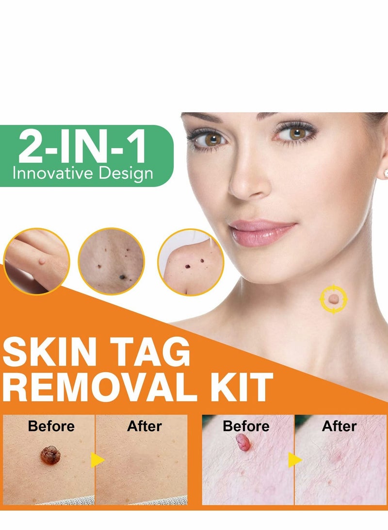 Excefore Skin-Tag-Remover, 2 in-1 Skin-Tag-Removal Device Kit for Small to Large Size (2mm-7mm) Skin-Tags, Painless Remover-Tags for Most Body Parts - Image 5