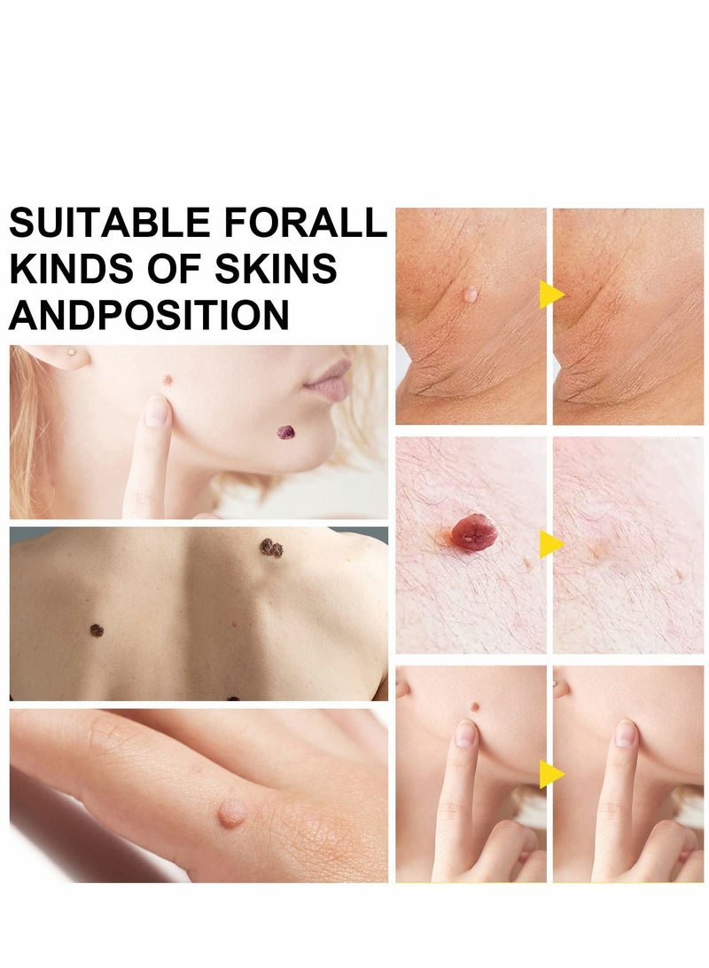 Excefore Skin-Tag-Remover, 2 in-1 Skin-Tag-Removal Device Kit for Small to Large Size (2mm-7mm) Skin-Tags, Painless Remover-Tags for Most Body Parts - Image 2