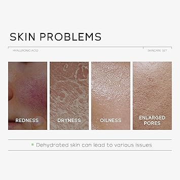 Quiyum Hyaluronic Acid Skincare Set Hydrating Face Care Kit for Dry Normal Skin Facial CleanserTonerSerumEye CreamFace Cream Pamper Gift Set for Women Teenage Girls Mom Birthday Travel Kit - Image 3