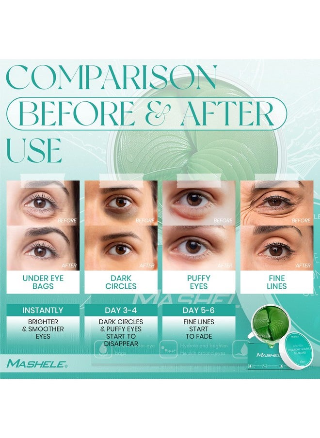 MASHELE - Aloe Vera Gel Eye Mask Skin Care 60 Pcs Hyaluronic Acid Collagen Under Eye Patches For Dark Circles And Puffiness Reduce Wrinkle Patches Pure Natural Extract Korean Eye Patch - Image 1