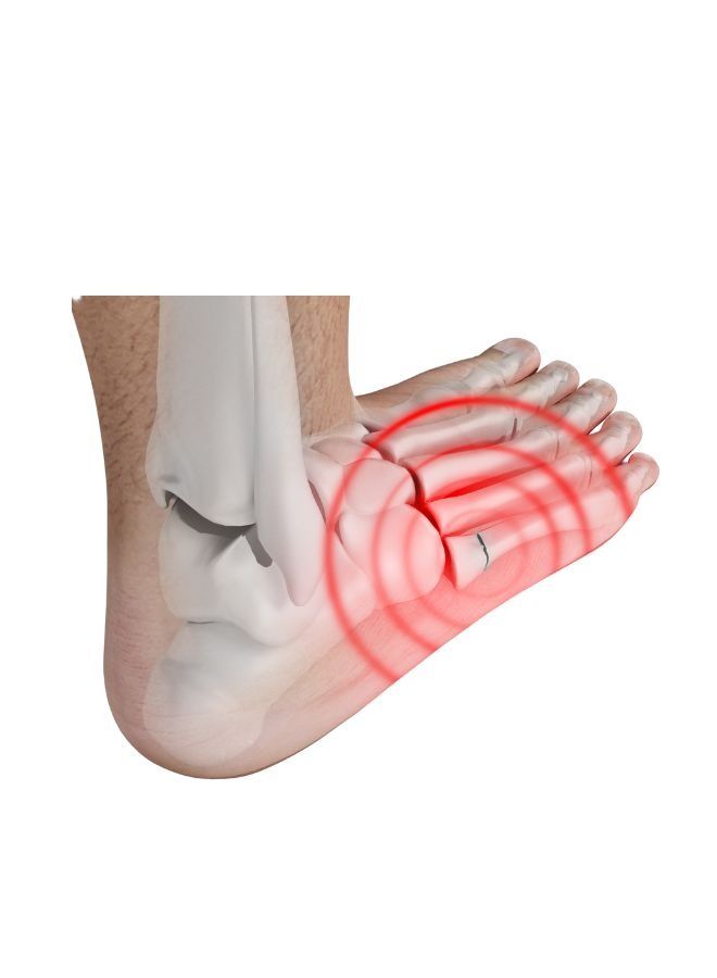 موف حذاء مشي قصير متأرجح للإصابات والتأهيل بعد العمليات – MV044 - Image 4