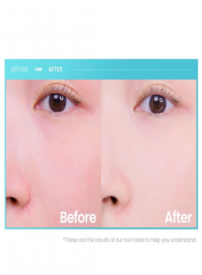 أيضا قناع الوجه ilso Pore Tension، عبوة من 10 أقنعة، 25 مل × 10، مع الببتيد وحمض الهيالورونيك - Image 5