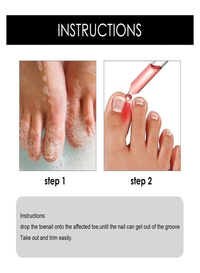 ROYALS RADIANCE Ingrown Toenail Softening & Care Drops | Nail Softener & Foot Hygiene Solution | Helps Reduce Discomfort, Prevents Inflammation, Disinfects & Supports Nail Health 50Ml x Pack 1 - Image 5