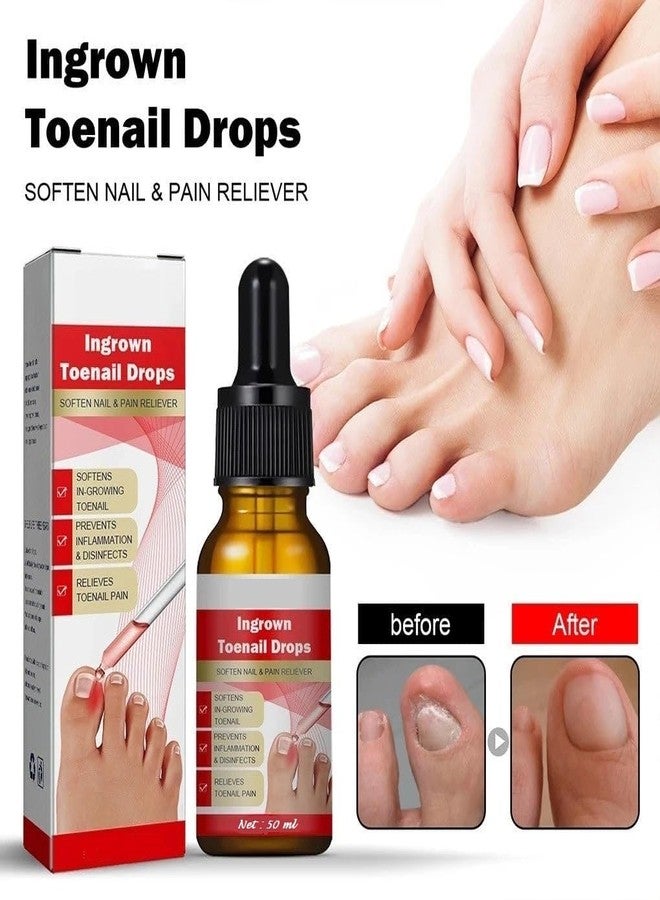 ROYALS RADIANCE Ingrown Toenail Softening & Care Drops | Nail Softener & Foot Hygiene Solution | Helps Reduce Discomfort, Prevents Inflammation, Disinfects & Supports Nail Health 50Ml x Pack 1 - Image 3